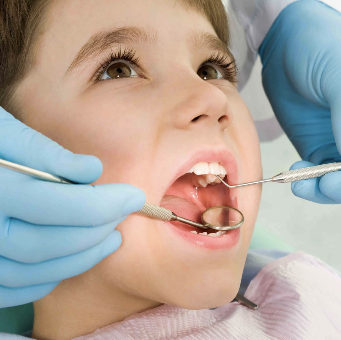 caries-enfants caries-enfants