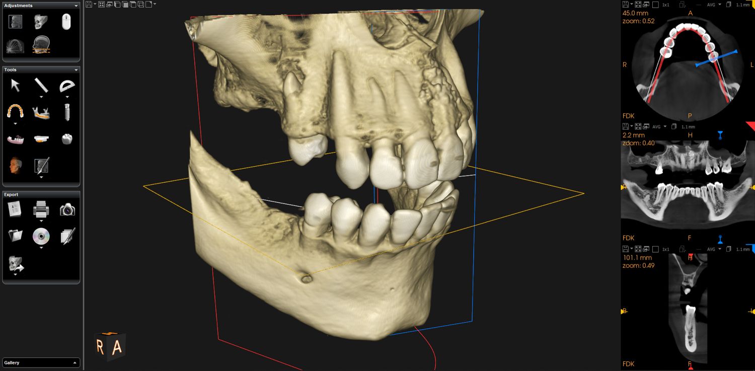 cone-beam-imagerie-3d cone-beam-imagerie-3d